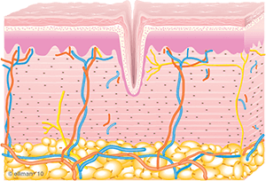 Graphic of skin not treated with TempSure Envi