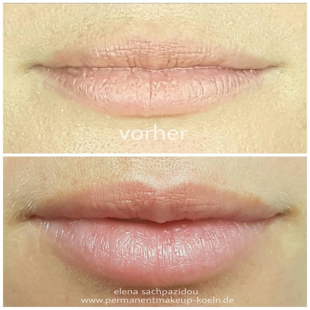 Ein Vorher-Nachher-Foto der Lippen einer Frau.