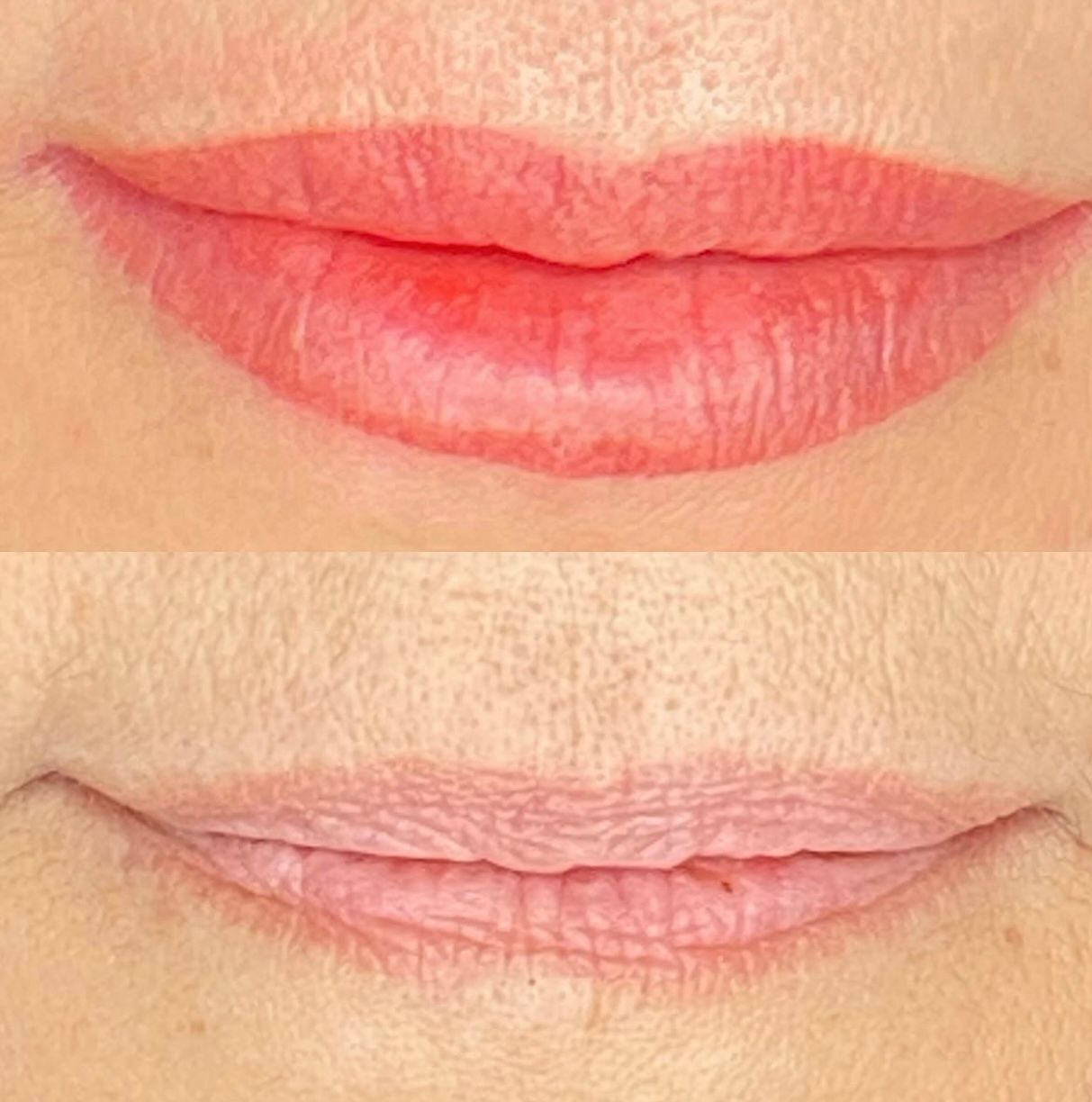 Ein Vorher-Nachher-Bild der Lippen einer Frau.