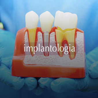 implantologia