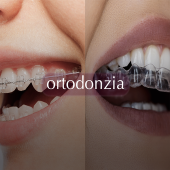 ortodonzia