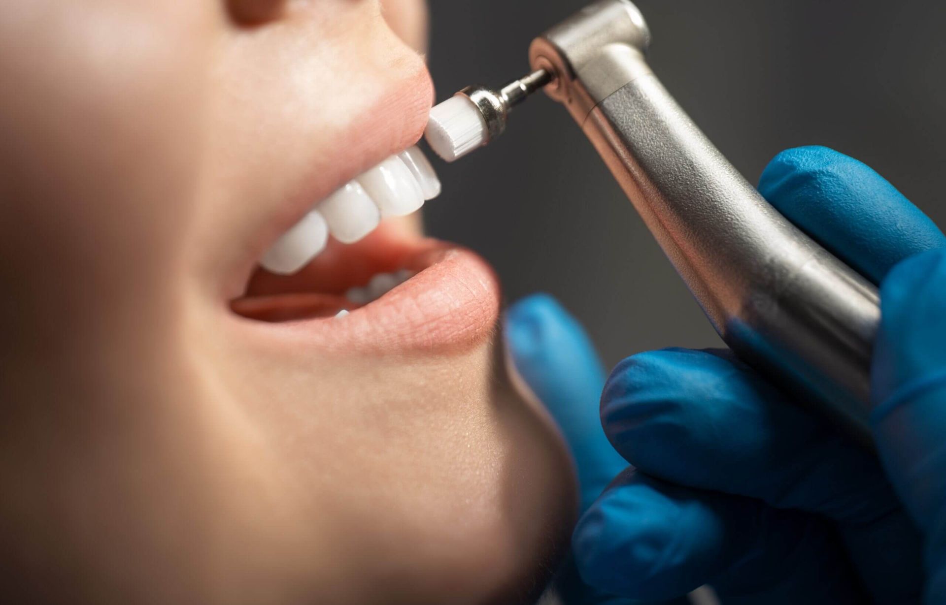 dental screenings
