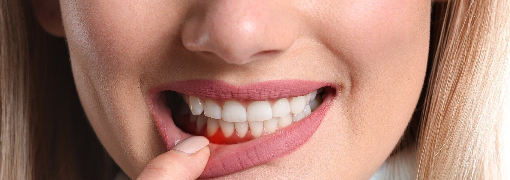 gum and bone
