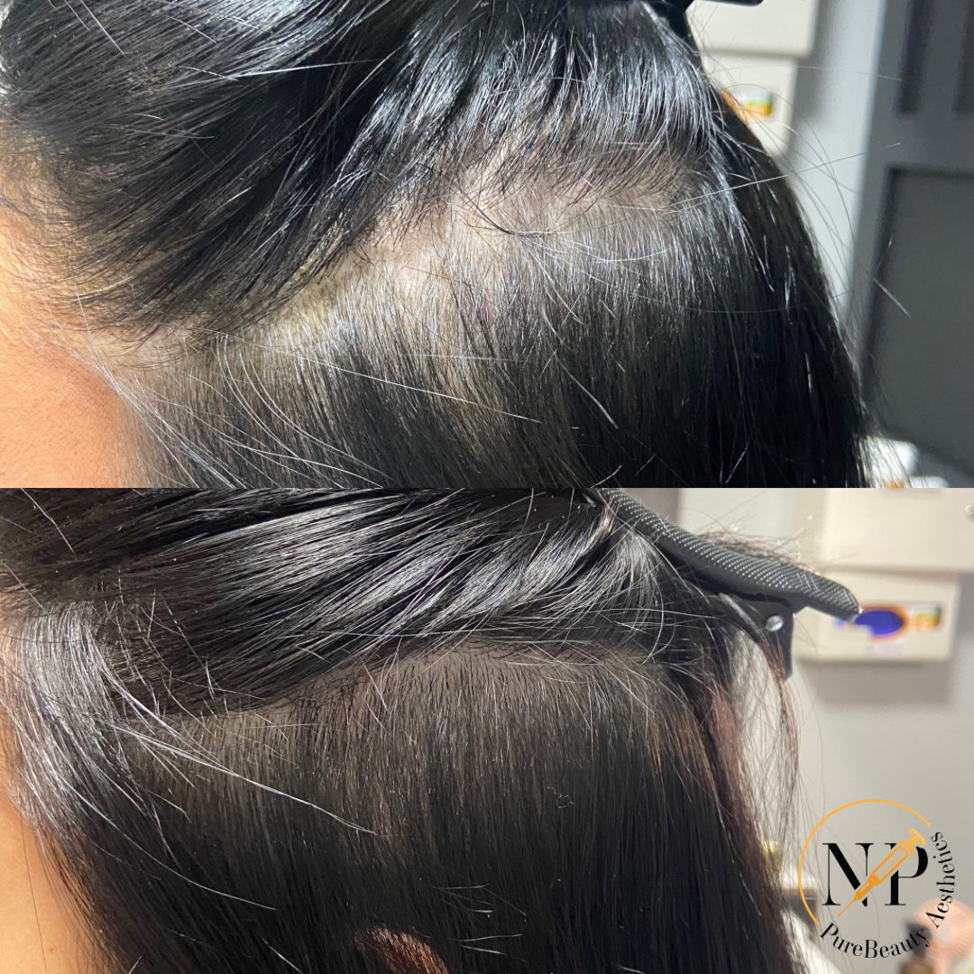 A before and after photo of a woman 's hair.