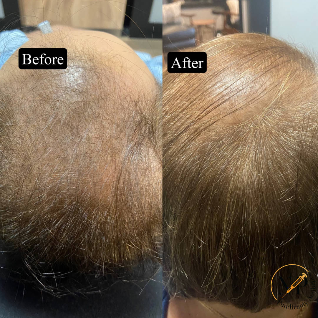 A before and after picture of a person 's hair.