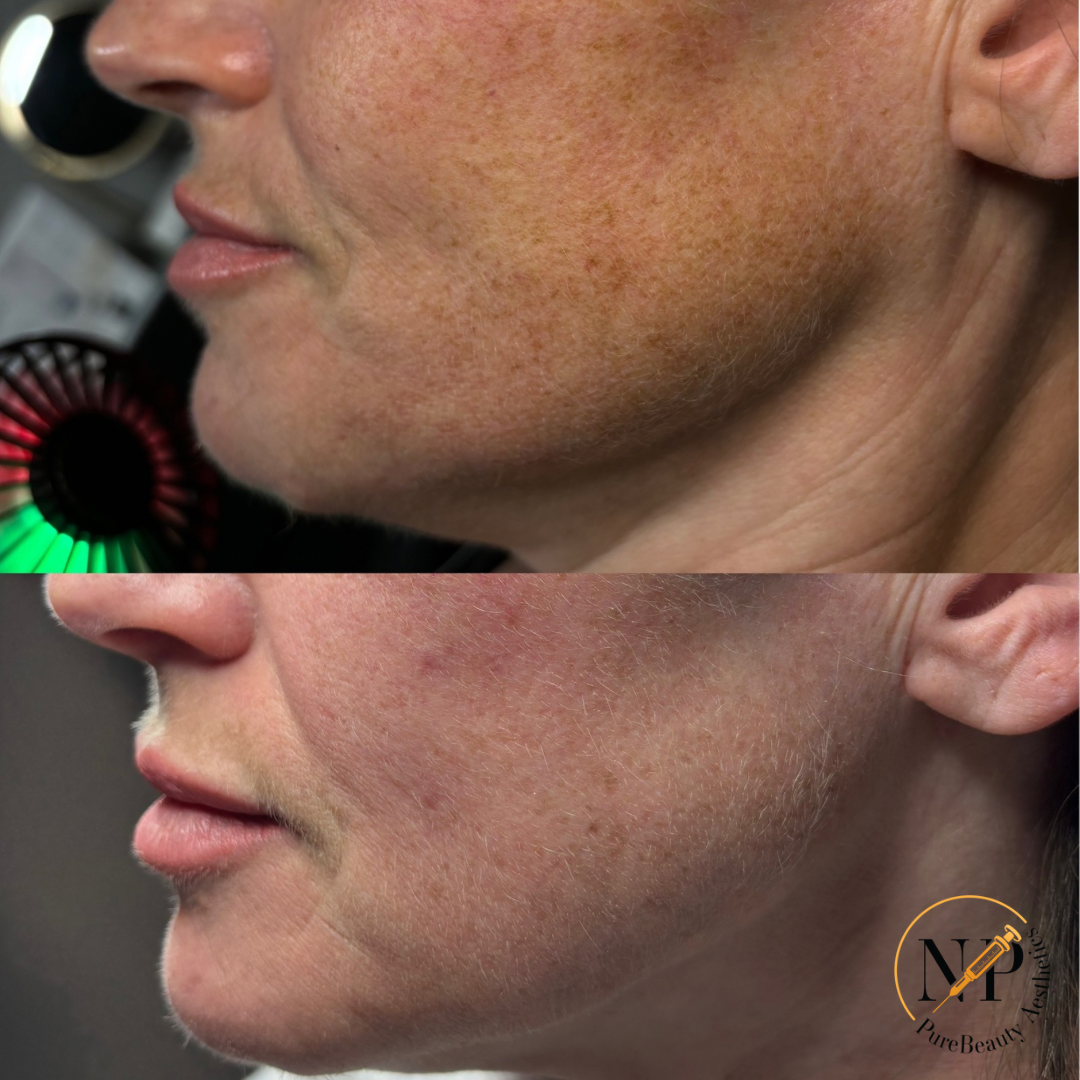 A before and after photo of a woman 's face