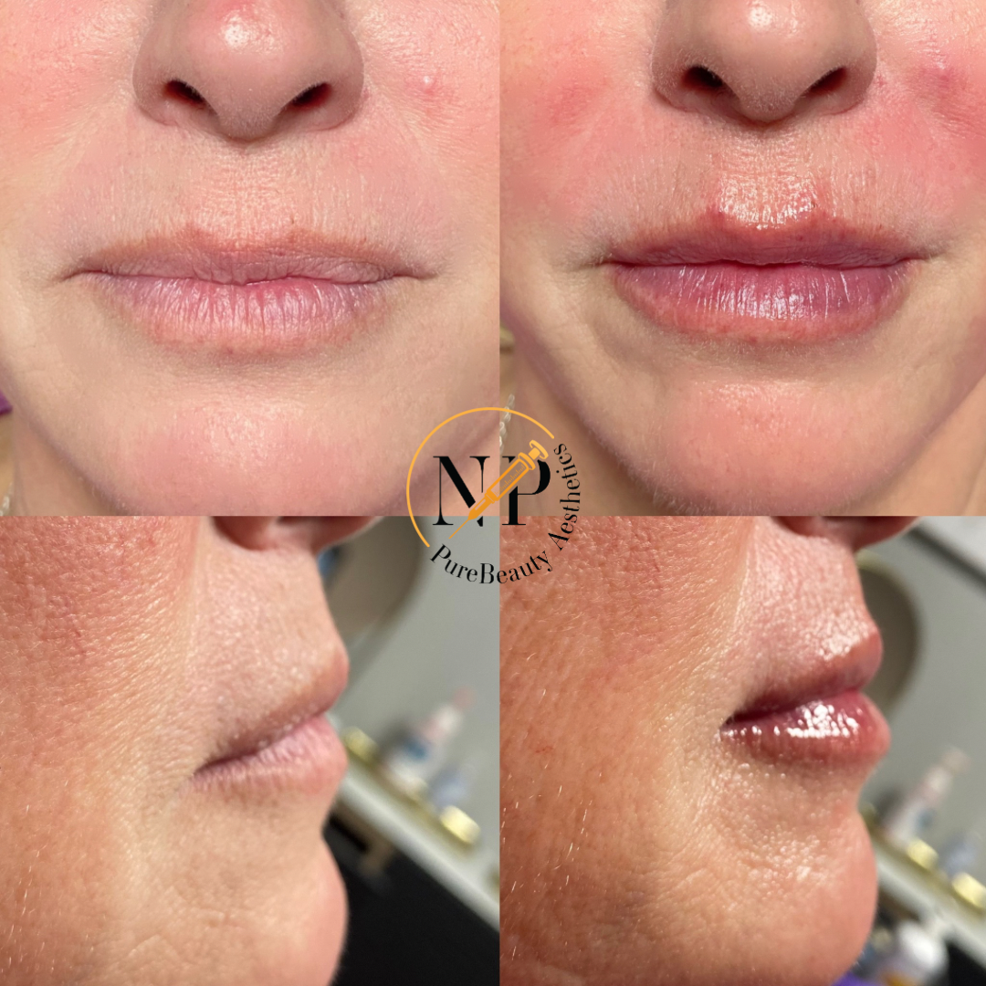 A woman 's lips are shown in a collage of four photos.
