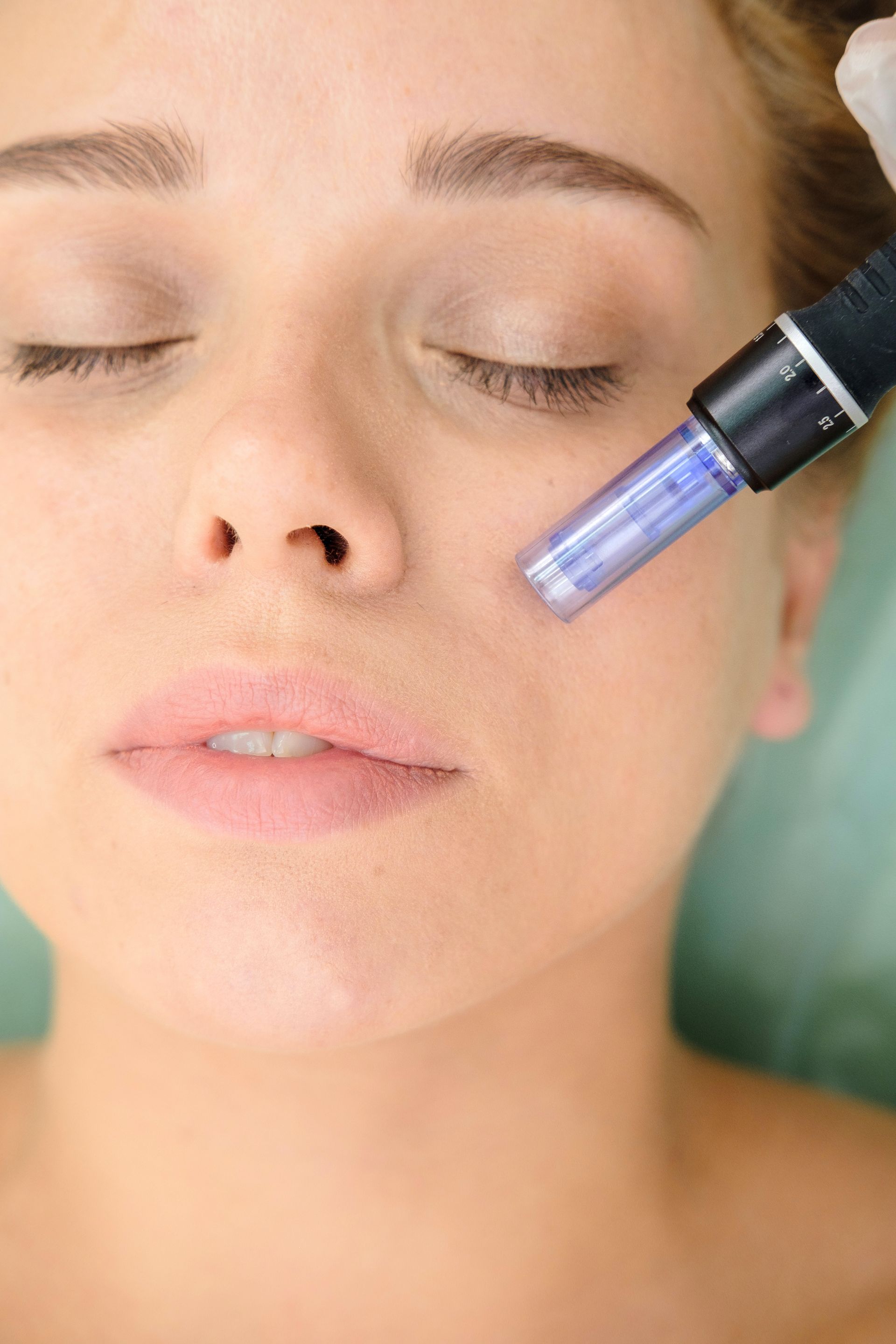 A woman is getting a cosmetic treatment on her face.