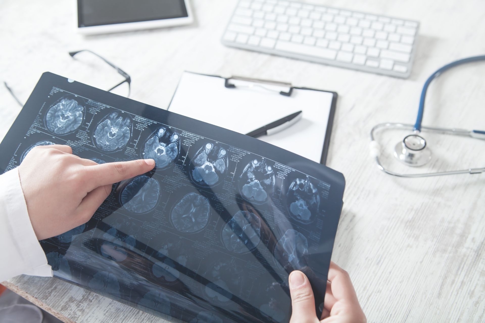 A picture of a doctor examining a MRI of a patient's head.