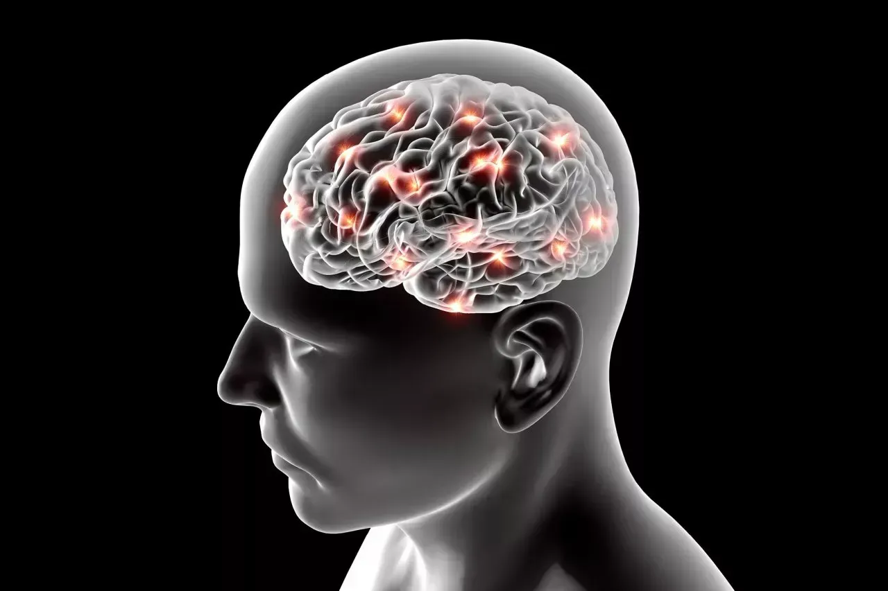 The inside diagram of a brain with Alzheimer's