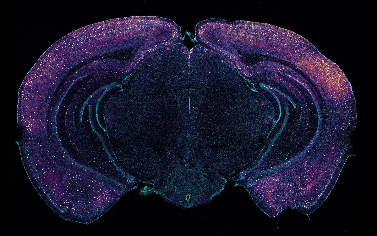 A colored microscope image of a mouse brain with many dots lit within.