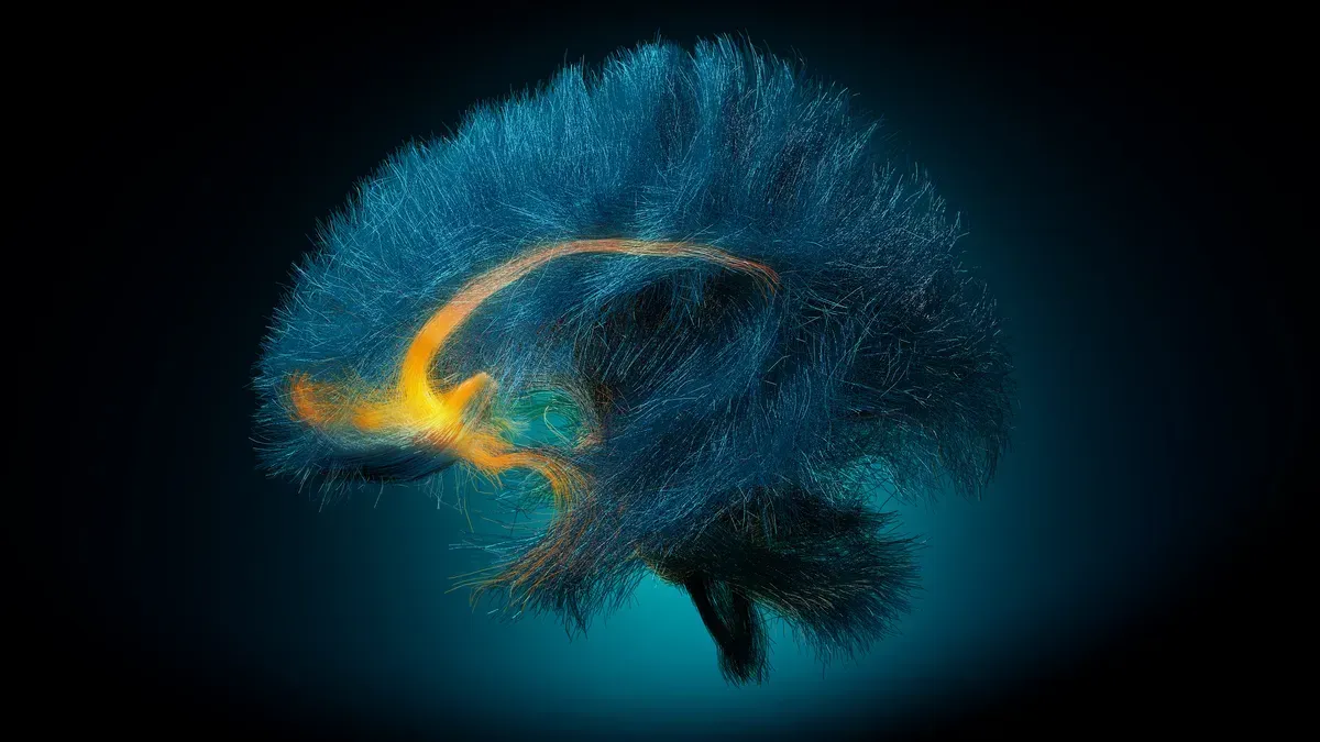 Blue and gold fibrous texture in the shape of brain
