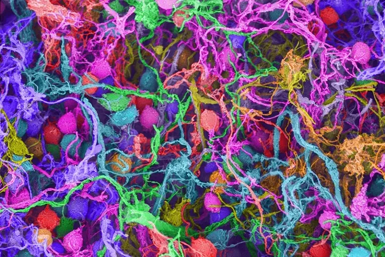 Scanning electron micrograph of human brain cells — can psychedelics rewire them safely?