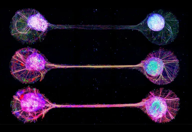 ‘Connectoids’ use microfluid channels to recapitulate and study neural connections.