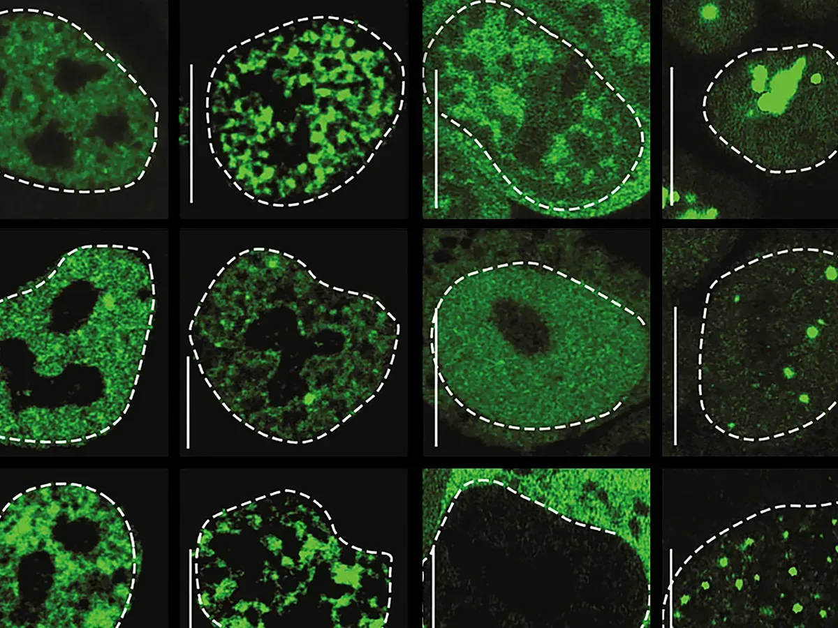 ProtGPS predicts the localization of proteins (green dots), both in their normal and disease-causing