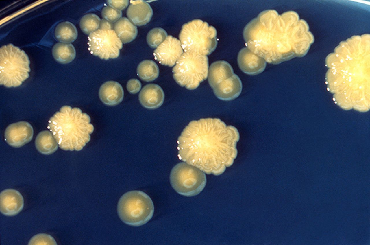 An insidious superbug, Enterobacter cloacae, can leave patients in dire circumstances.