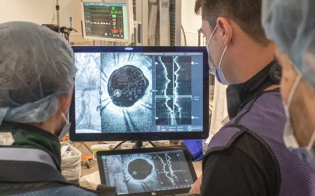 Medical staffers view a computer screen showing the inside of a narrowed artery.