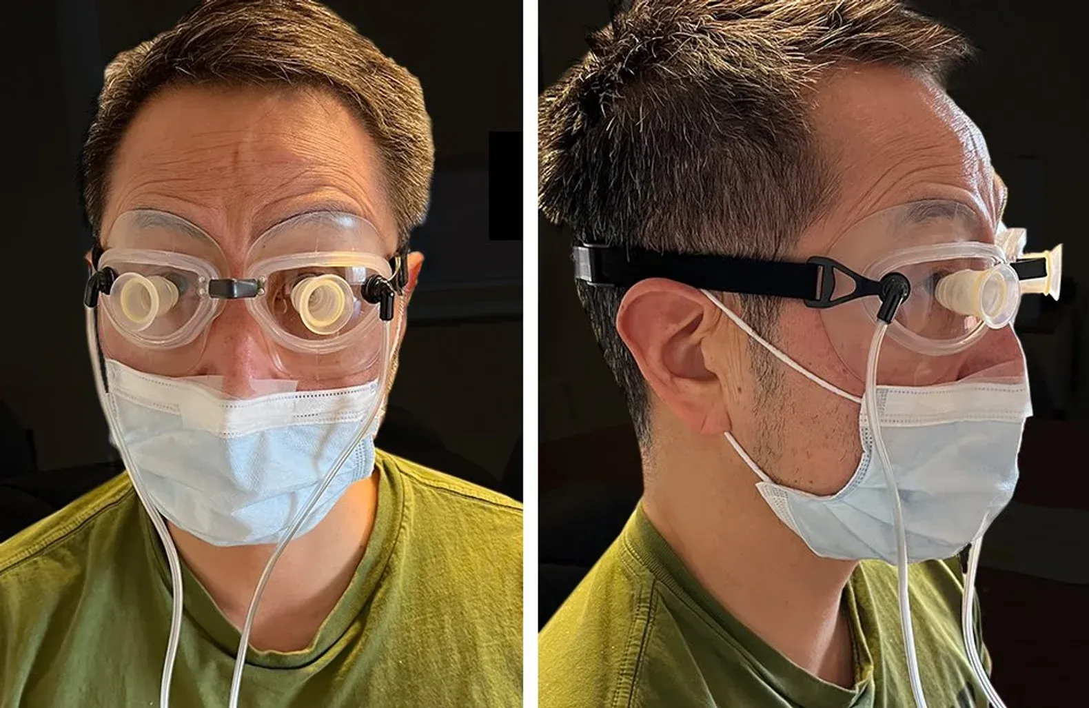 Man wearing the FSYX Ocular Pressure Adjusting Pump device for glaucoma treatment.