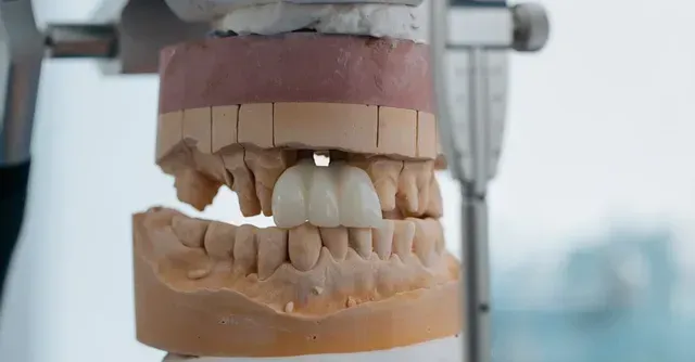 Hallmark Dental providing dentures and partial dentures in Danvers and Leominster, MA
