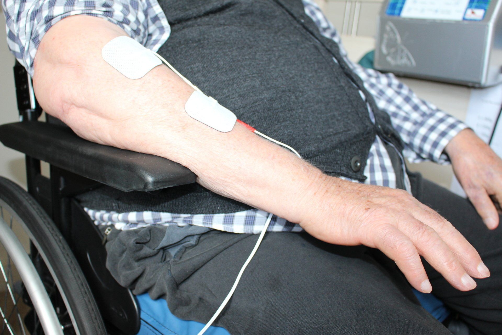 Electrical muscle stimulation after stroke