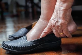 Woman Putting Her Shoes — Heel Pain in Wappingers Falls, NY