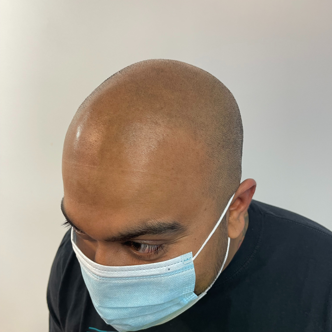 A bald man wearing a face mask is looking down.