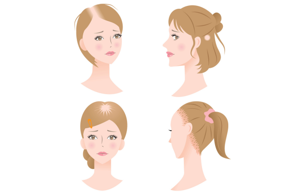 A woman is shown from different angles with different hairstyles.