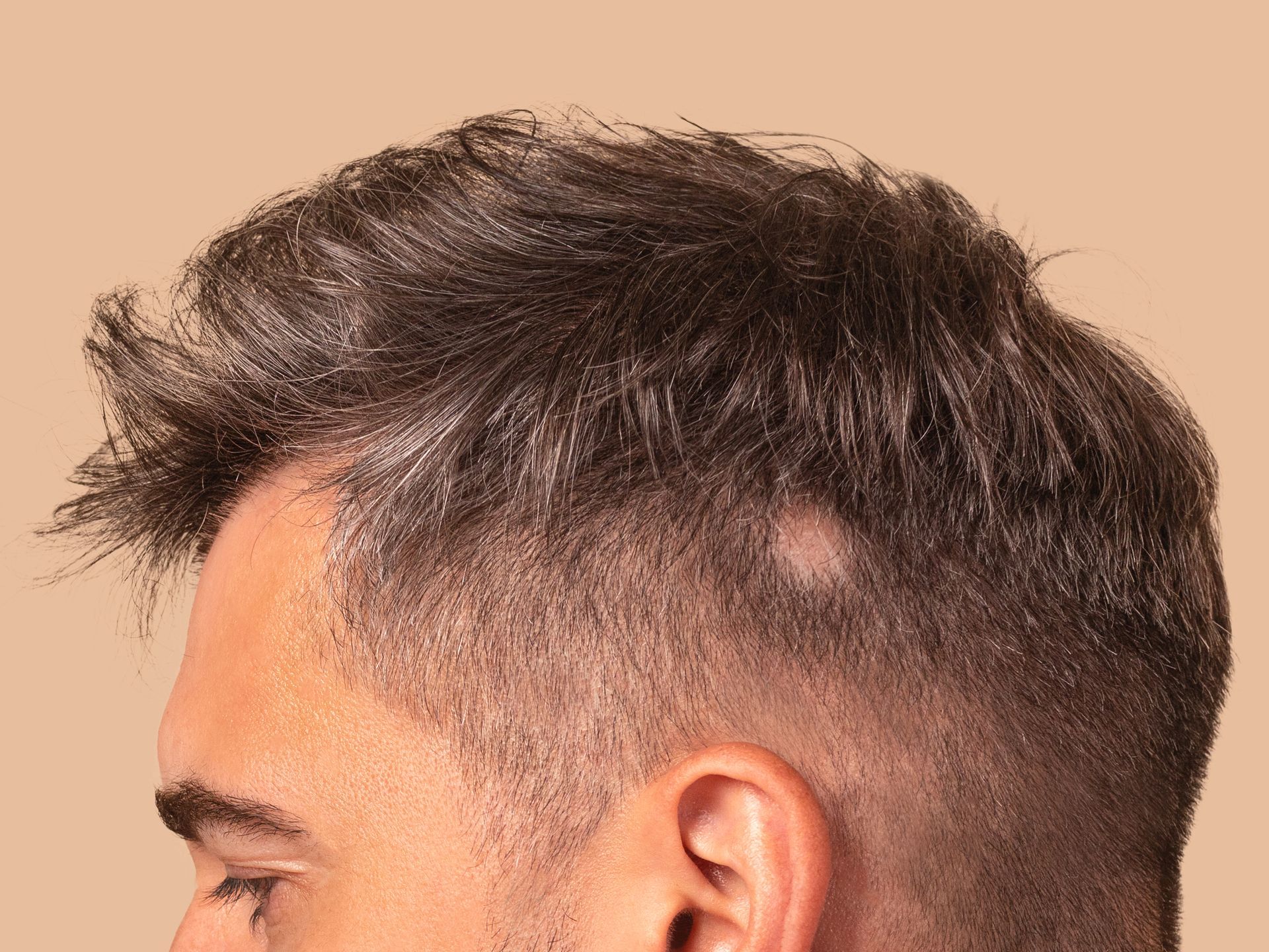 A man with a bald spot on his head.