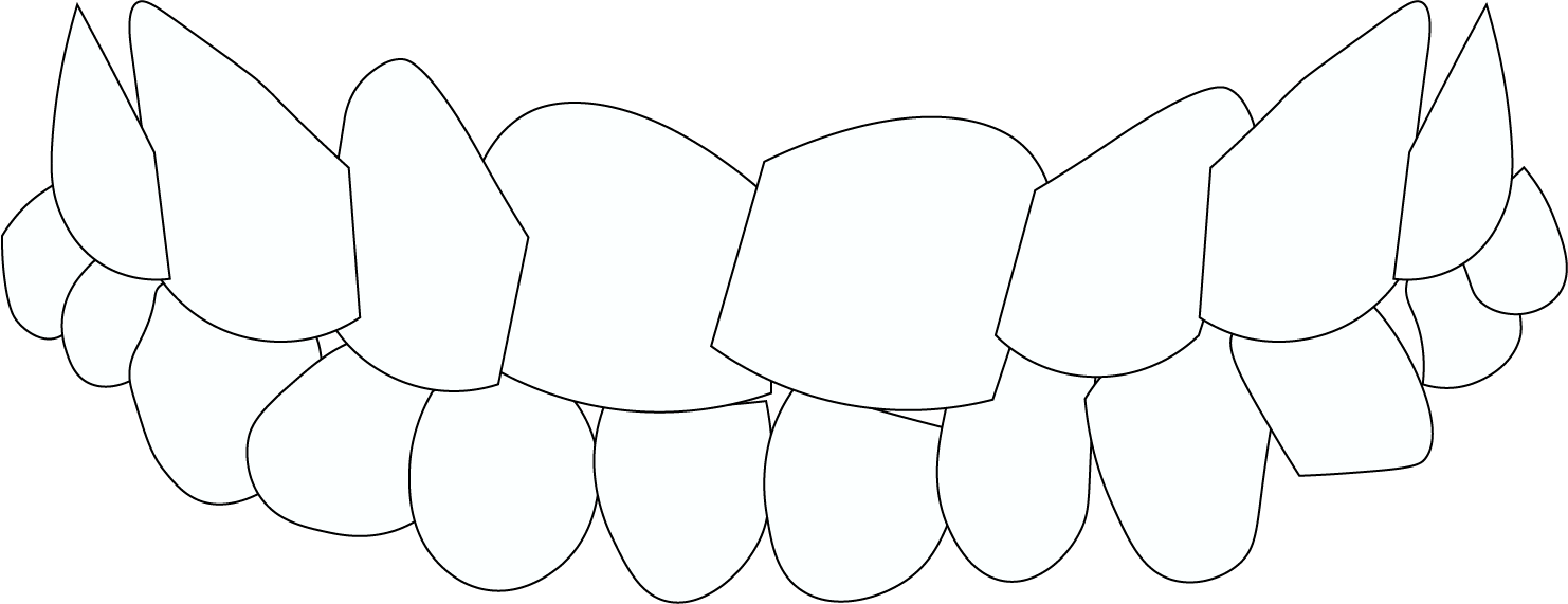 A black and white drawing of a person 's teeth on a white background.