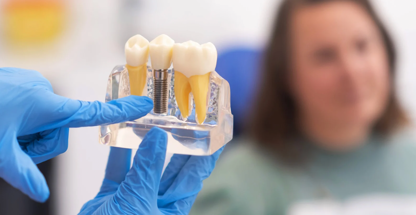 How Do Dental Implants Work? Everything You Need to Know