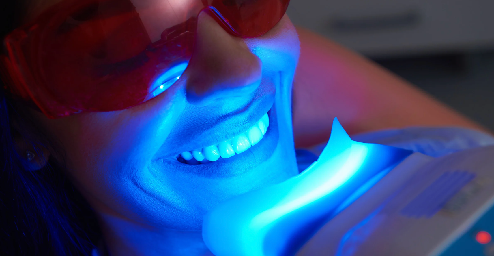 Professional Teeth Whitening vs. At-Home Methods