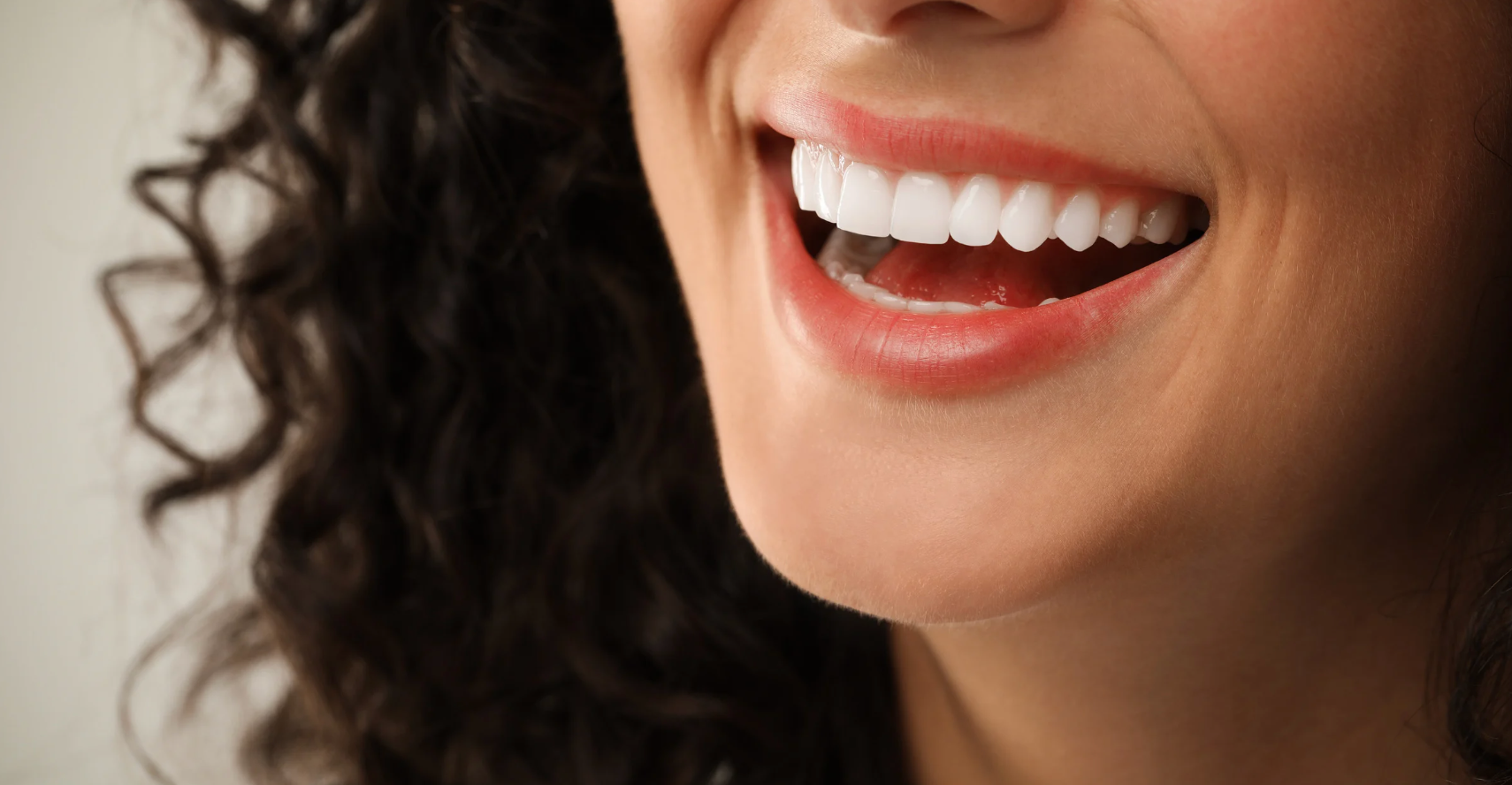 What Are Dental Veneers? Pros, Cons, and Costs Explained