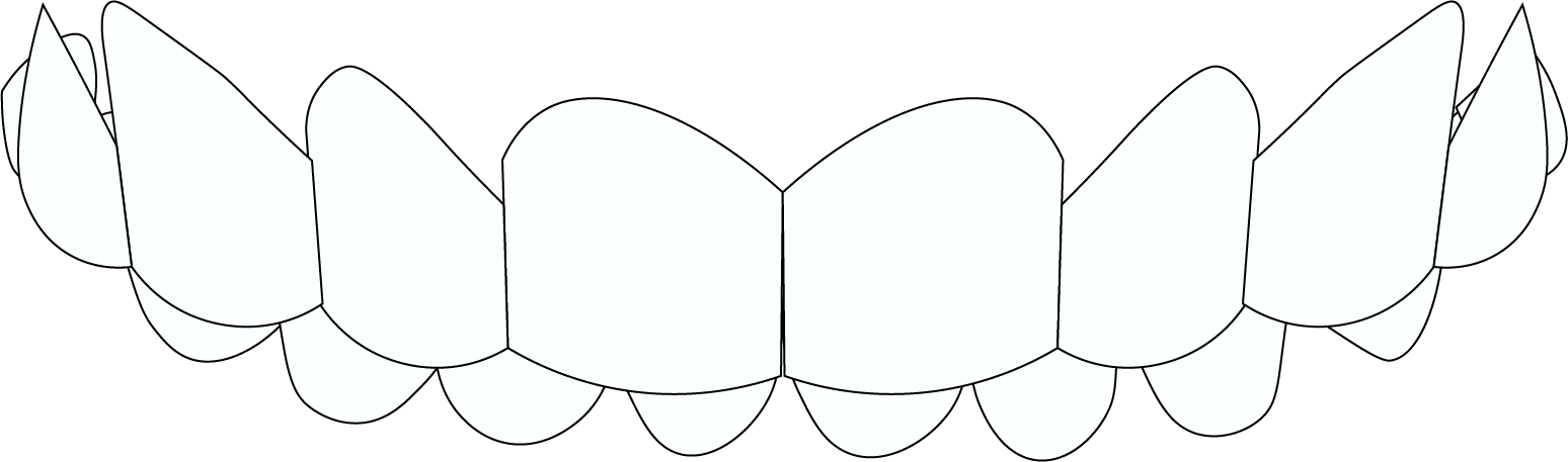 A black and white drawing of a row of teeth on a white background.