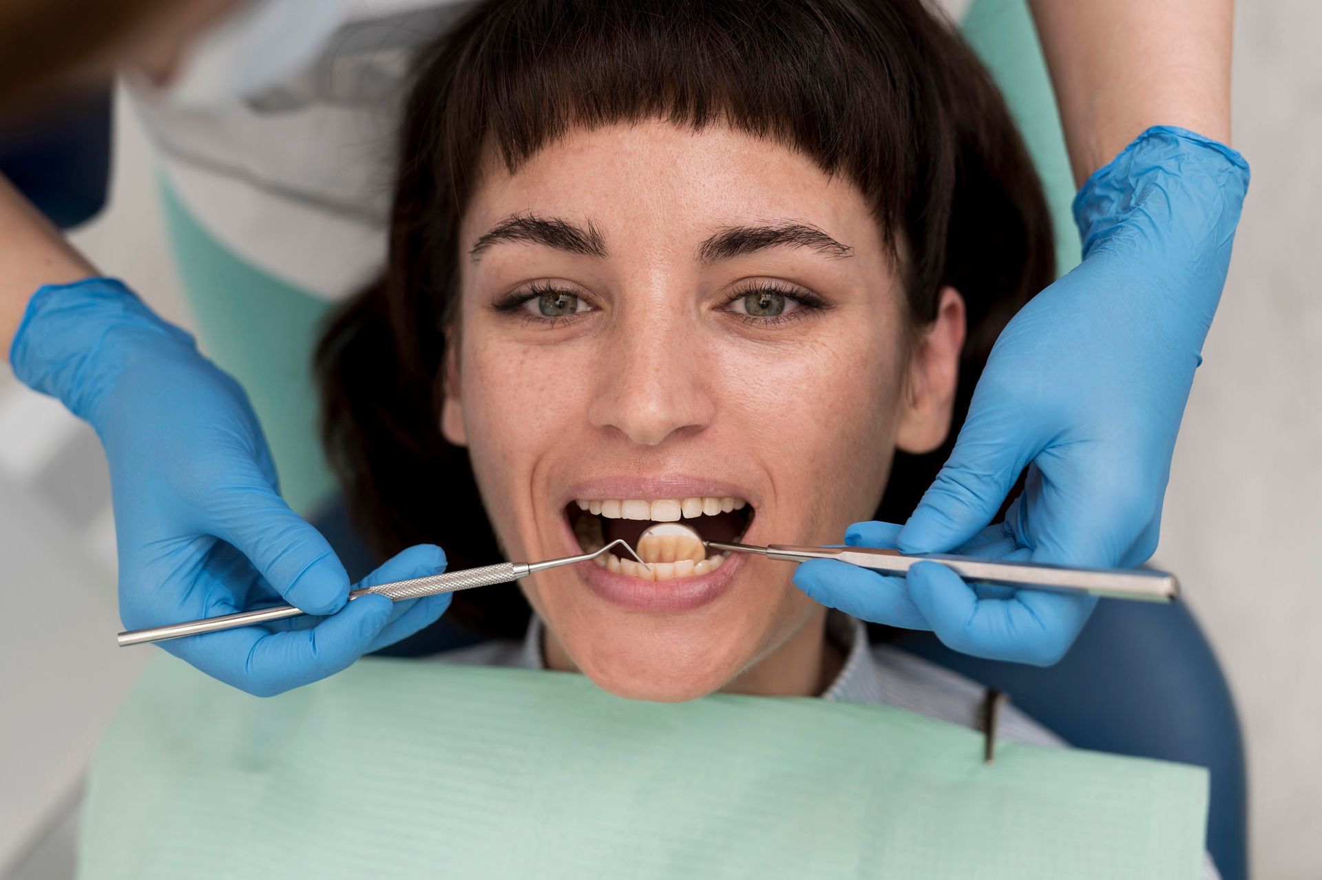 Composite Restorations in Mason