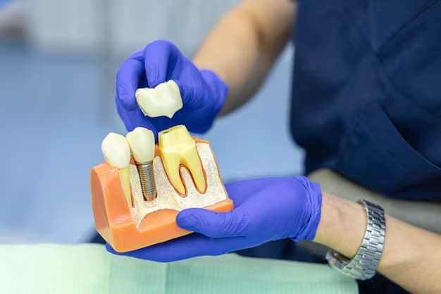 dental implant in Mason

