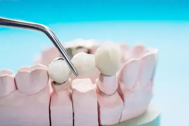 dental crown in Mason