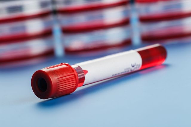 bpc 157 for lupus BPC-157 PEPTIDE 5MG/10MG VIAL – UMBRELLA Labs main image 0