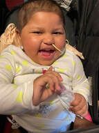 Smiling child in a white onesie, feeding tube in nose, sitting in a stroller.