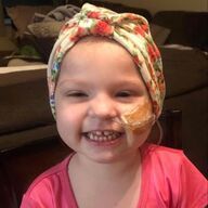 Smiling child wearing a floral headscarf and feeding tube.