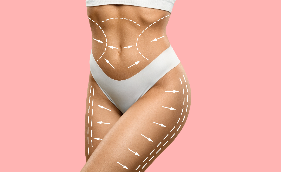 Woman Body