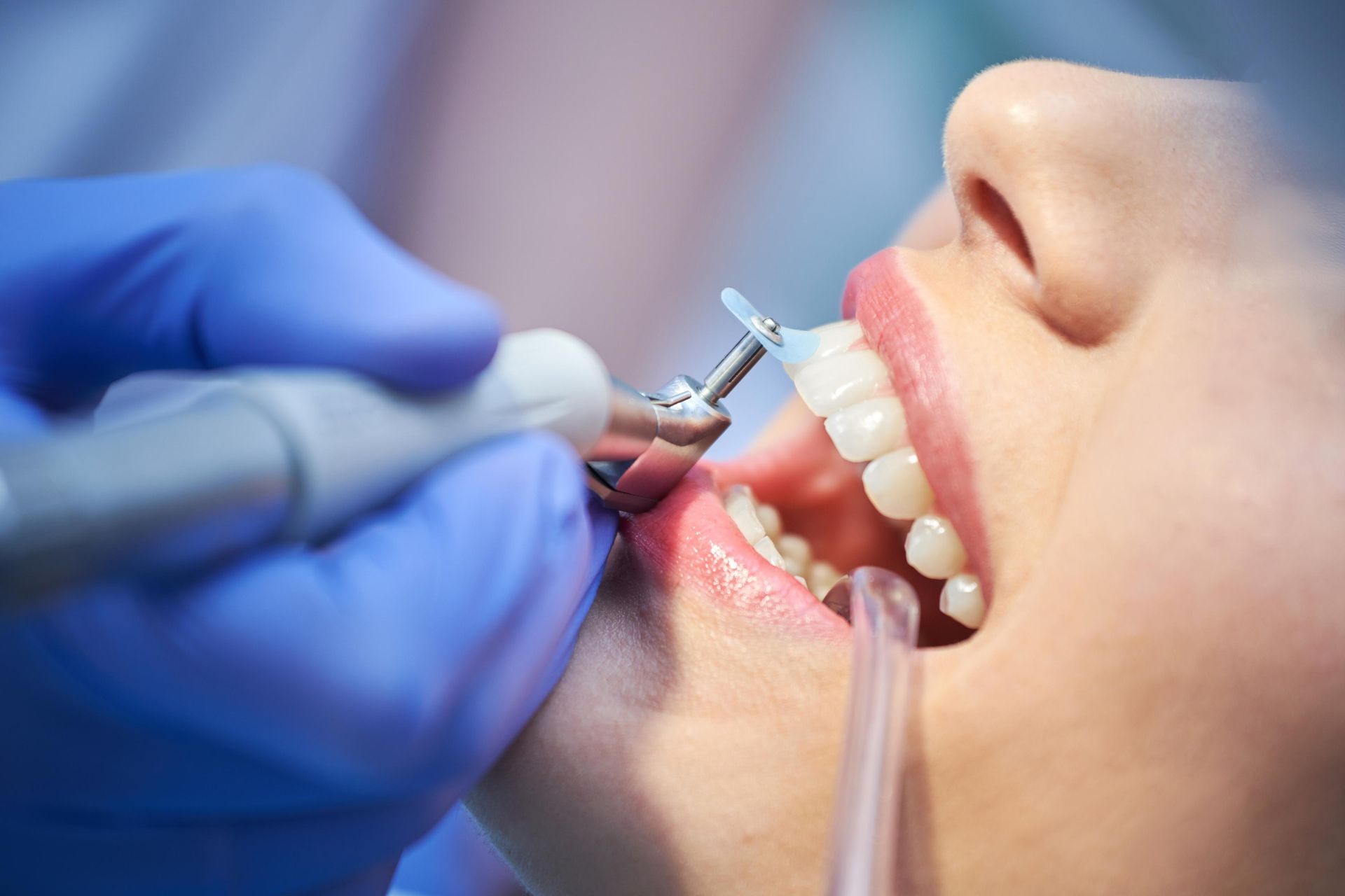 A dentist in blue gloves uses a polishing tool to clean a patient's teeth during a dental exam.