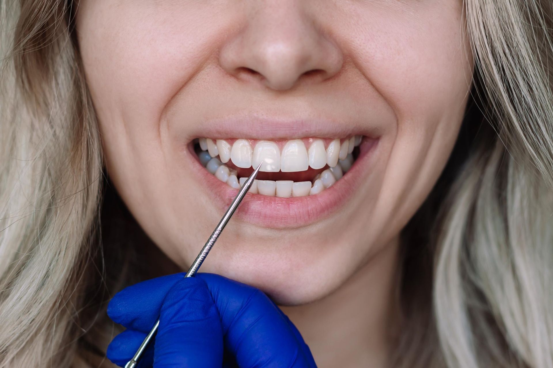 A dental professional in blue gloves uses a metal probe to examine a patient's teeth.