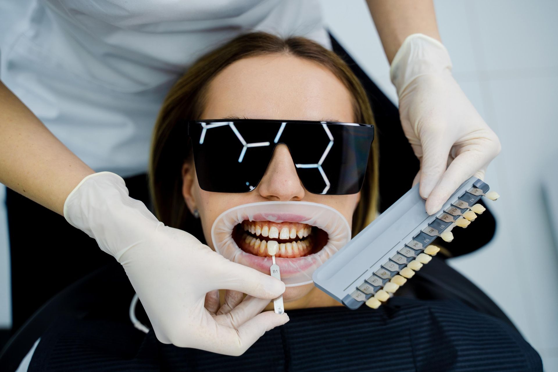 A dentist uses a shade guide to match the tooth color of a patient wearing protective eyewear and a mouth retractor.