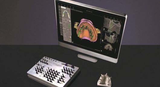 Implantologia con computer
