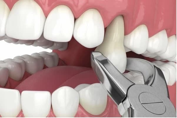 Chirurgia dentale