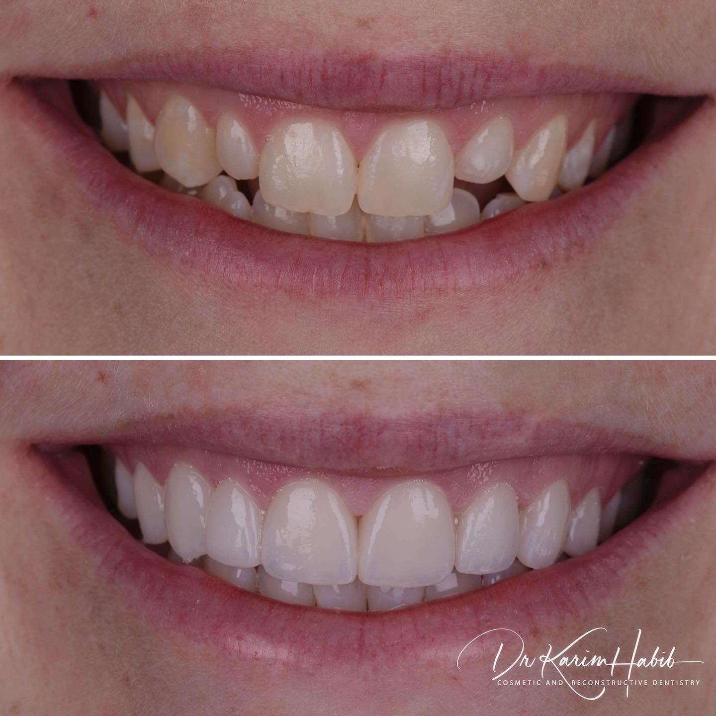 Electrical Install at Open space