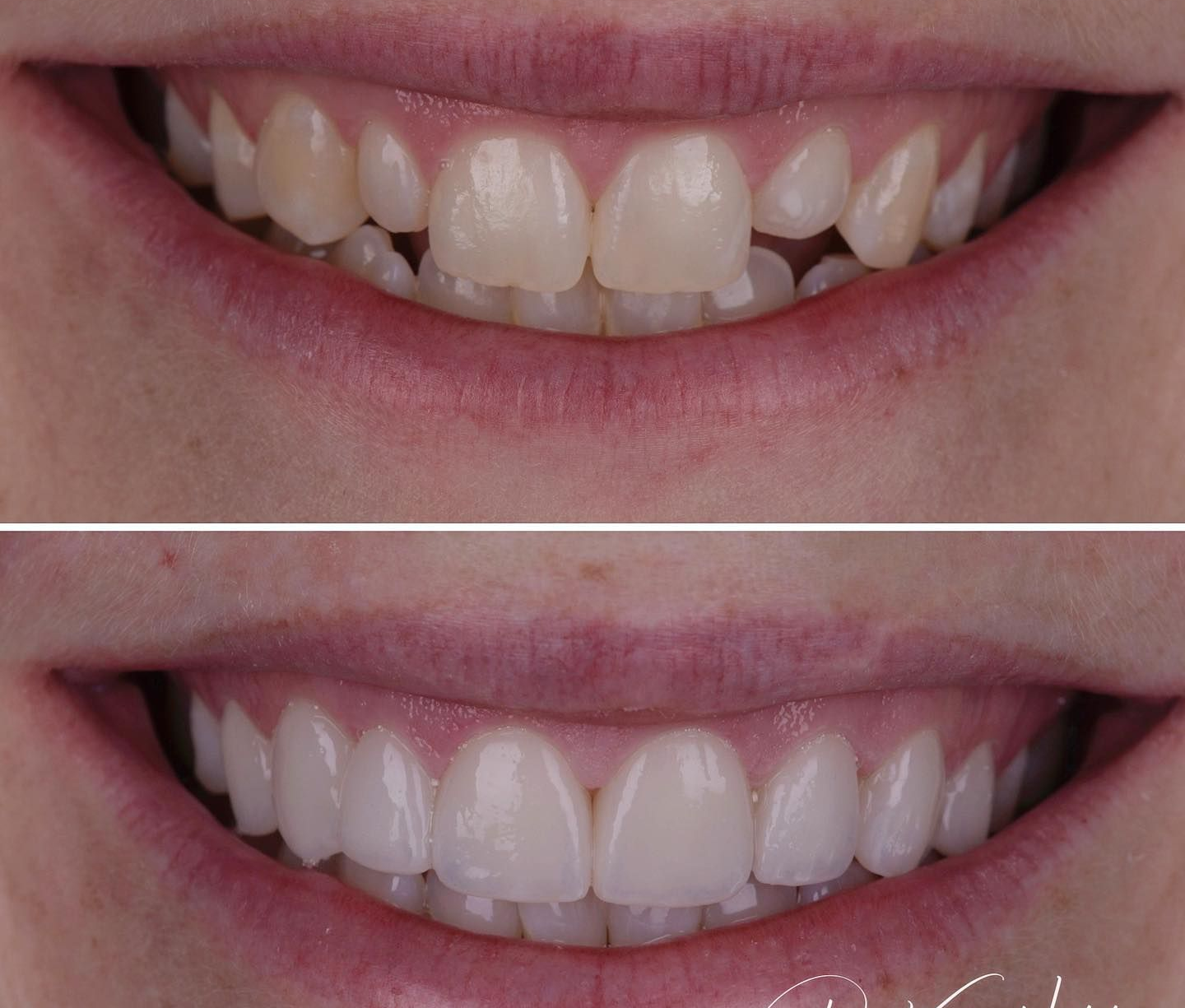 Electrical Install at Open space