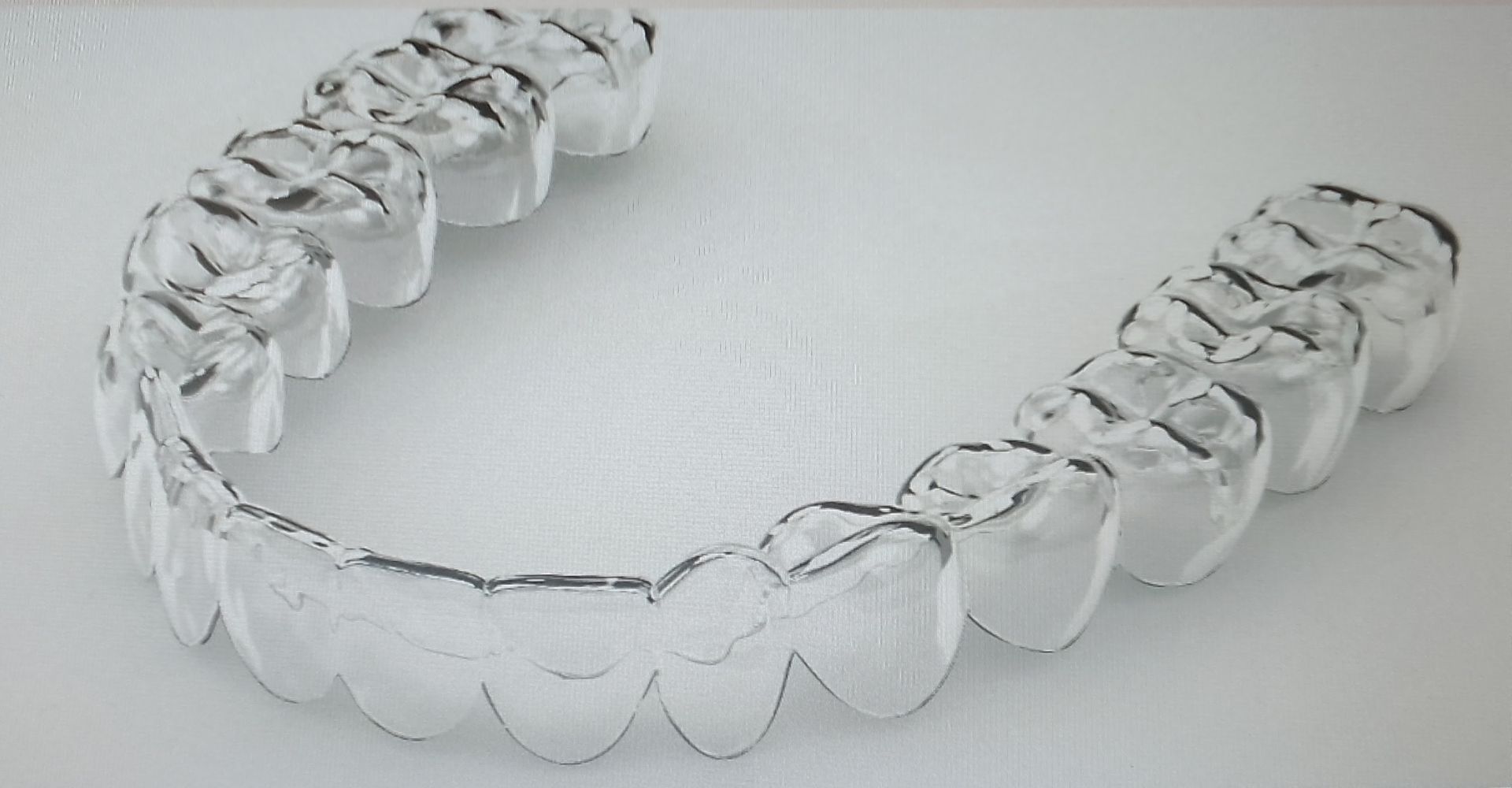 ortodonzia invisibile