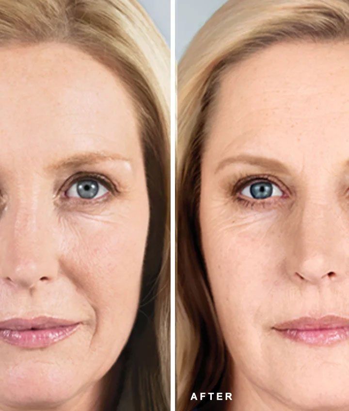 Treatments Effects Results — Sydney, NSW — Lulu Cosmetics