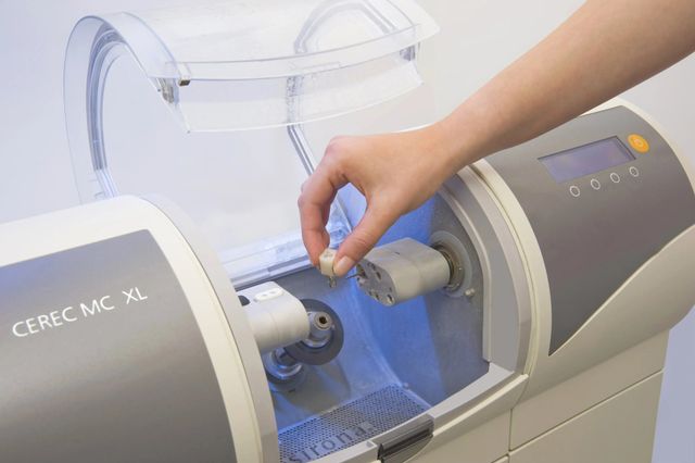 Same Day Crowns | Spring Hill Dental Center | Spring Hill, TN